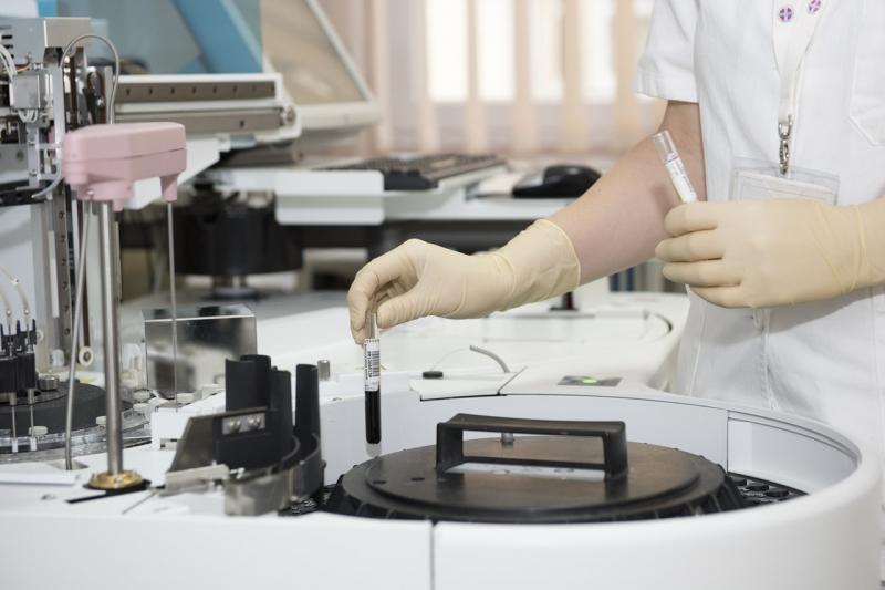 Cromatografia Líquida e Gasosa: Benefícios Essenciais